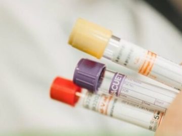 Протоколы исследования на титры антител к вирусу бешенства оформляются в электронном виде