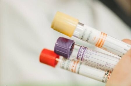 Протоколы исследования на титры антител к вирусу бешенства оформляются в электронном виде